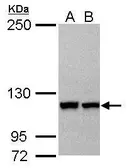Anti-IPO5 antibody [N1N2], N-term used in Western Blot (WB). GTX114515