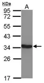 Anti-Lactate Dehydrogenase C antibody used in Western Blot (WB). GTX114525