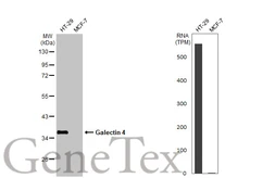 Anti-Galectin 4 antibody used in Western Blot (WB). GTX114527