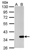 Anti-Galectin 4 antibody used in Western Blot (WB). GTX114527