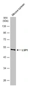 Anti-LSP1 antibody [N2C3] used in Western Blot (WB). GTX114533