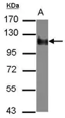 Anti-NBR1 antibody used in Western Blot (WB). GTX114539