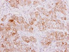 Anti-SMAD9 antibody used in IHC (Paraffin sections) (IHC-P). GTX114540