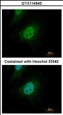 Anti-SMAD9 antibody used in Immunocytochemistry/ Immunofluorescence (ICC/IF). GTX114540