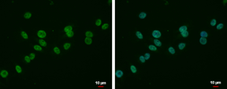Anti-MLLT6 antibody used in Immunocytochemistry/ Immunofluorescence (ICC/IF). GTX114552