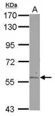Anti-ALDH6A1 antibody used in Western Blot (WB). GTX114553