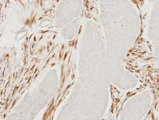 Anti-MOCS2 antibody [N1C3] used in IHC (Paraffin sections) (IHC-P). GTX114554