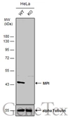 Anti-MPI antibody used in Western Blot (WB). GTX114556