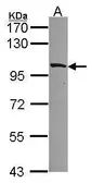 Anti-MYO1B antibody [C2C3], C-term used in Western Blot (WB). GTX114557