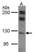 Anti-MYO1B antibody [N1N2], N-term used in Western Blot (WB). GTX114558