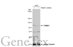 Anti-TRIM37 antibody [N1N2], N-term used in Western Blot (WB). GTX114565