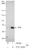 Anti-NAB2 antibody [N3C2], Internal used in Immunoprecipitation (IP). GTX114568