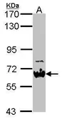 Anti-NAB2 antibody [N3C2], Internal used in Western Blot (WB). GTX114568