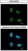 Anti-CBP80 antibody [N1N2], N-term used in Immunocytochemistry/ Immunofluorescence (ICC/IF). GTX114570