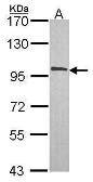 Anti-CBP80 antibody [N1N2], N-term used in Western Blot (WB). GTX114570