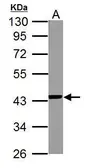 Anti-NDUFA10 antibody used in Western Blot (WB). GTX114572
