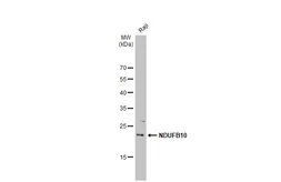 Anti-NDUFB10 antibody [N1C3] used in Western Blot (WB). GTX114576