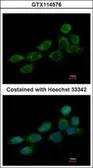 Anti-NDUFB10 antibody [N1C3] used in Immunocytochemistry/ Immunofluorescence (ICC/IF). GTX114576
