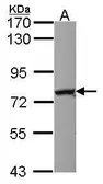 Anti-Nrf1 antibody [C1C3] used in Western Blot (WB). GTX114581