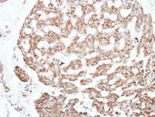 Anti-NFIC antibody used in IHC (Paraffin sections) (IHC-P). GTX114583