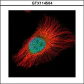 Anti-IKB beta antibody used in Immunocytochemistry/ Immunofluorescence (ICC/IF). GTX114584