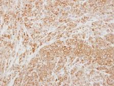 Anti-NP2 antibody [N3C3] used in IHC (Paraffin sections) (IHC-P). GTX114590