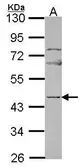 Anti-NP2 antibody [N3C3] used in Western Blot (WB). GTX114590