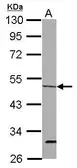Anti-ORC4L antibody [C1C3] used in Western Blot (WB). GTX114601
