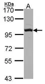 Anti-OSBP antibody [N2C1], Internal used in Western Blot (WB). GTX114602