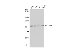 Anti-OSBP antibody [C2C3], C-term used in Western Blot (WB). GTX114603