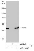 Anti-P2Y2 antibody [N3C3] used in Immunoprecipitation (IP). GTX114609