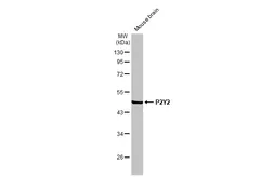 Anti-P2Y2 antibody [N3C3] used in Western Blot (WB). GTX114609