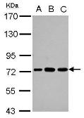 Anti-PABPC3 antibody used in Western Blot (WB). GTX114611