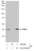 Anti-PCBP2 antibody [N1C1] used in Immunoprecipitation (IP). GTX114616