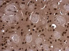 Anti-PCBP2 antibody used in IHC (Paraffin sections) (IHC-P). GTX114617