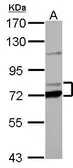 Anti-PCCA antibody used in Western Blot (WB). GTX114618