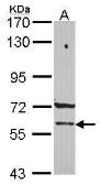 Anti-PCCB antibody [C1C3] used in Western Blot (WB). GTX114619