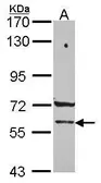Anti-PCCB antibody [C1C3] used in Western Blot (WB). GTX114619
