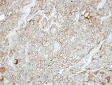 Anti-PCDH1 antibody [C2C3], C-term used in IHC (Paraffin sections) (IHC-P). GTX114620