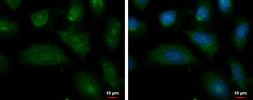 Anti-Autotaxin antibody used in Immunocytochemistry/ Immunofluorescence (ICC/IF). GTX114627
