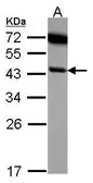 Anti-SERPINB6 antibody [N1C1] used in Western Blot (WB). GTX114636