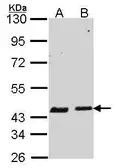 Anti-SERPINB6 antibody [N2C2], Internal used in Western Blot (WB). GTX114637