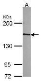 Anti-RPB2 antibody [C2C3], C-term used in Western Blot (WB). GTX114647