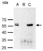 Anti-Brn2 antibody used in Immunoprecipitation (IP). GTX114650