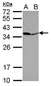 Anti-PPA1 antibody [N2C3] used in Western Blot (WB). GTX114651