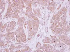 Anti-PPEF1 antibody used in IHC (Paraffin sections) (IHC-P). GTX114652