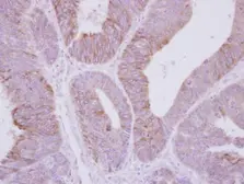 Anti-PPP2R3A antibody [C2C3], C-term used in IHC (Paraffin sections) (IHC-P). GTX114655