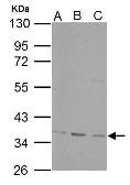 Anti-PPP4C antibody used in Western Blot (WB). GTX114659