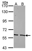 Anti-PPP3CC antibody [N1C1] used in Western Blot (WB). GTX114660