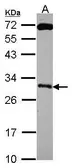 Anti-Kallikrein 10 antibody [N2C3] used in Western Blot (WB). GTX114670